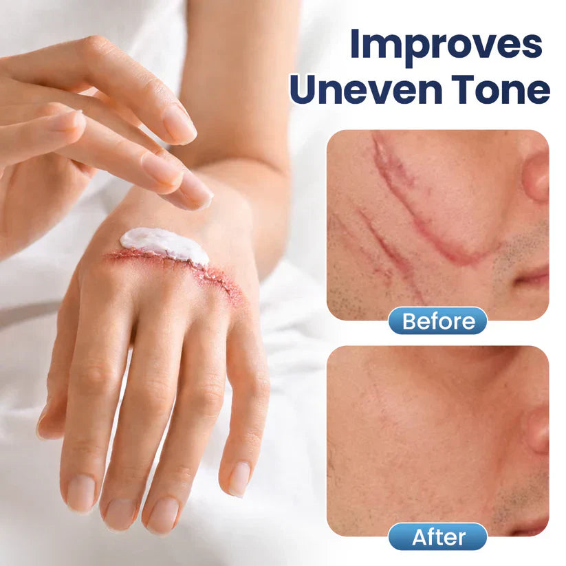 Texture Repair Gel