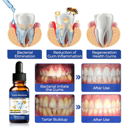 Smileasego™ Gum Restore Solution,Gum Regrowth Helps Dry Mouth and Bad Breath