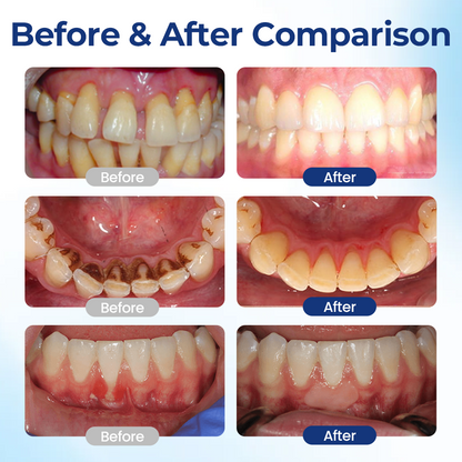 Smileasego™ Gum Restore Solution,Gum Regrowth Helps Dry Mouth and Bad Breath
