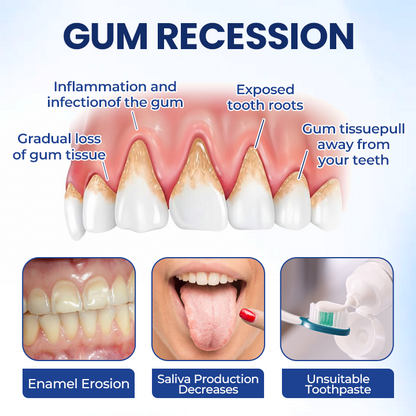 Smileasego™ Gum Restore Solution,Gum Regrowth Helps Dry Mouth and Bad Breath