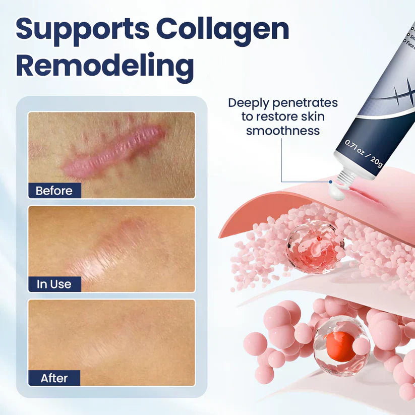 Texture Repair Gel