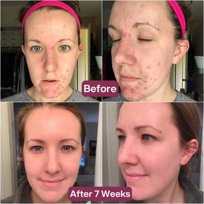 Snail 96 Mucin Mask