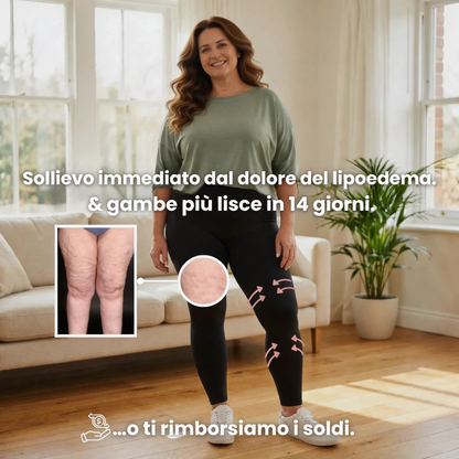 Leggings 3D  : dì addio al dolore e al gonfiore del lipedema in modo naturale
