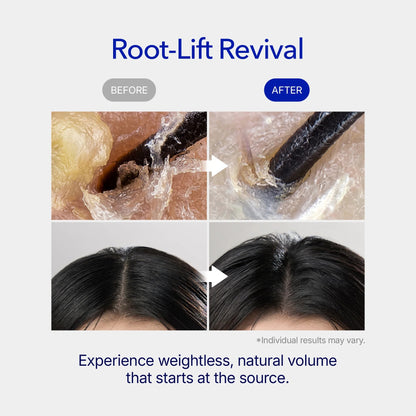 [Buy 1 Get 1] ViveLeb Spioxyl™ Scalp Serum 400 – 220K Micro-Spicules for Thicker, Fuller Hair | Korea’s Best-Selling Dermatologist-Recommended K-Beauty Volume Booster Serum (0.5 fl oz)