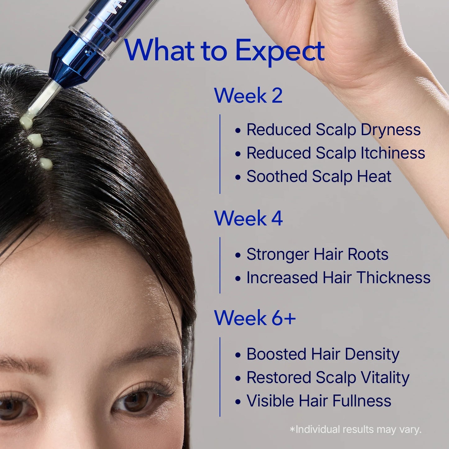 [Buy 1 Get 1] ViveLeb Spioxyl™ Scalp Serum 400 – 220K Micro-Spicules for Thicker, Fuller Hair | Korea’s Best-Selling Dermatologist-Recommended K-Beauty Volume Booster Serum (0.5 fl oz)