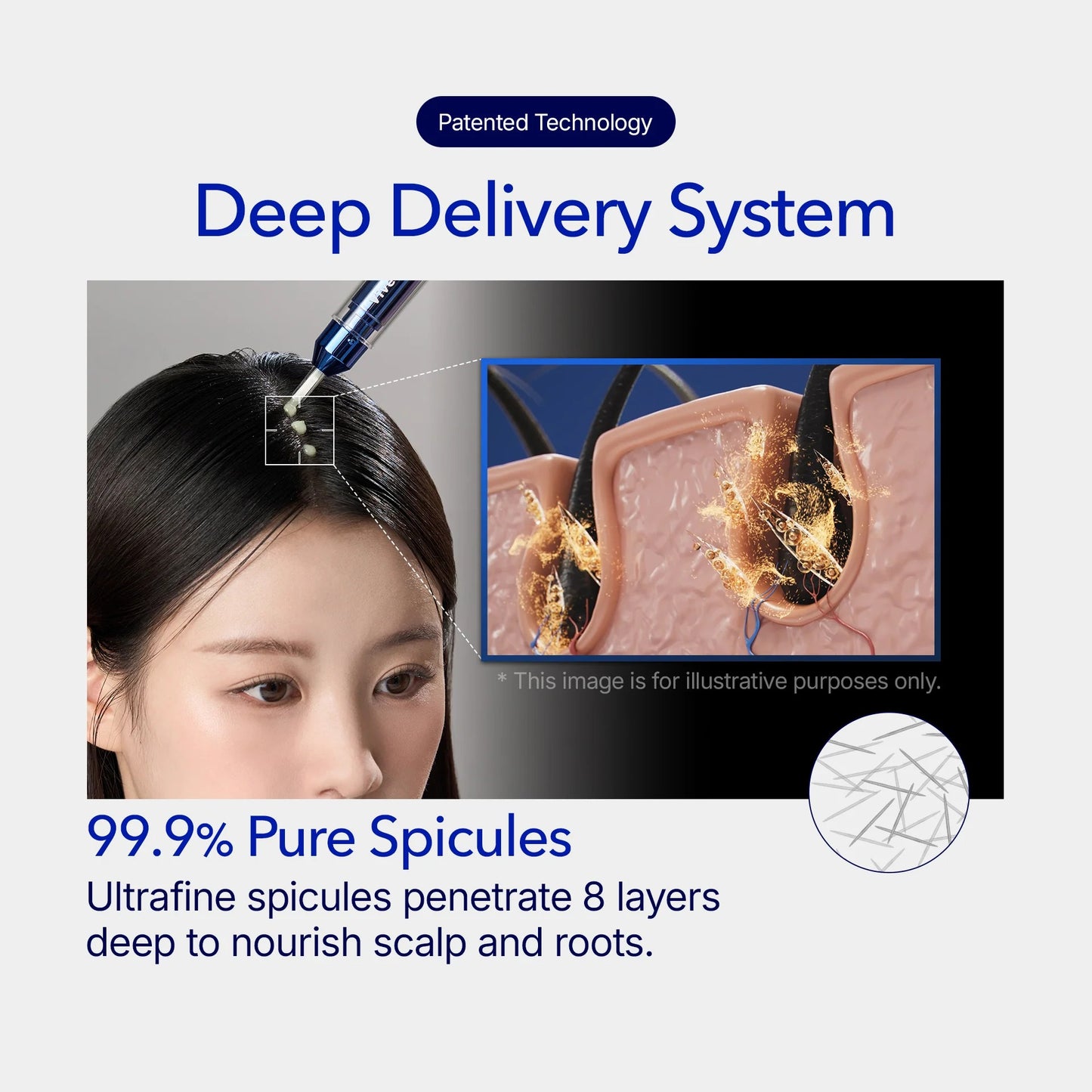 [Buy 1 Get 1] ViveLeb Spioxyl™ Scalp Serum 400 – 220K Micro-Spicules for Thicker, Fuller Hair | Korea’s Best-Selling Dermatologist-Recommended K-Beauty Volume Booster Serum (0.5 fl oz)