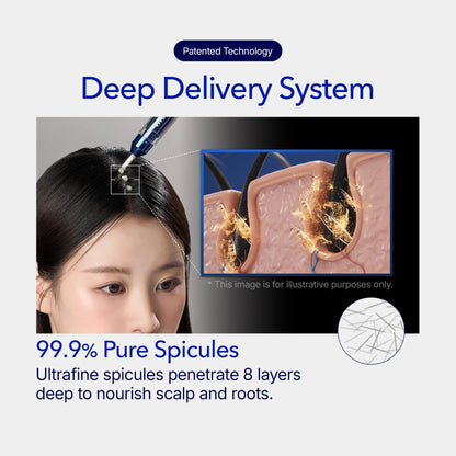 [Buy 1 Get 1] ViveLeb Spioxyl™ Scalp Serum 400 – 220K Micro-Spicules for Thicker, Fuller Hair | Korea’s Best-Selling Dermatologist-Recommended K-Beauty Volume Booster Serum (0.5 fl oz)