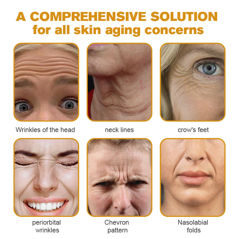 (Made and Shipped from USA) 🧑‍⚕️ Botox Bee Venom Wrinkle Removal Cream- LAST DAY 70% OFF🧑‍⚕️