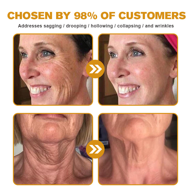 (Made and Shipped from USA) 🧑‍⚕️ Botox Bee Venom Wrinkle Removal Cream- LAST DAY 70% OFF🧑‍⚕️