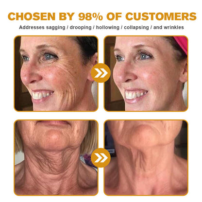 (Made and Shipped from USA) 🧑‍⚕️ Botox Bee Venom Wrinkle Removal Cream- LAST DAY 70% OFF🧑‍⚕️