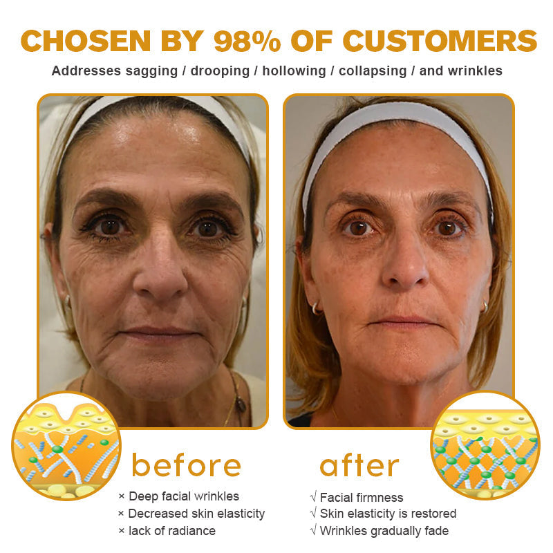 (Made and Shipped from USA) 🧑‍⚕️ Botox Bee Venom Wrinkle Removal Cream- LAST DAY 70% OFF🧑‍⚕️