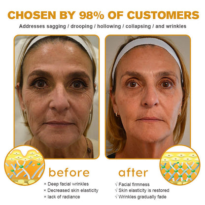 (Made and Shipped from USA) 🧑‍⚕️ Botox Bee Venom Wrinkle Removal Cream- LAST DAY 70% OFF🧑‍⚕️